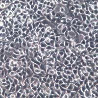 RD;恶性胚胎横纹肌瘤细胞、RD、RD细胞