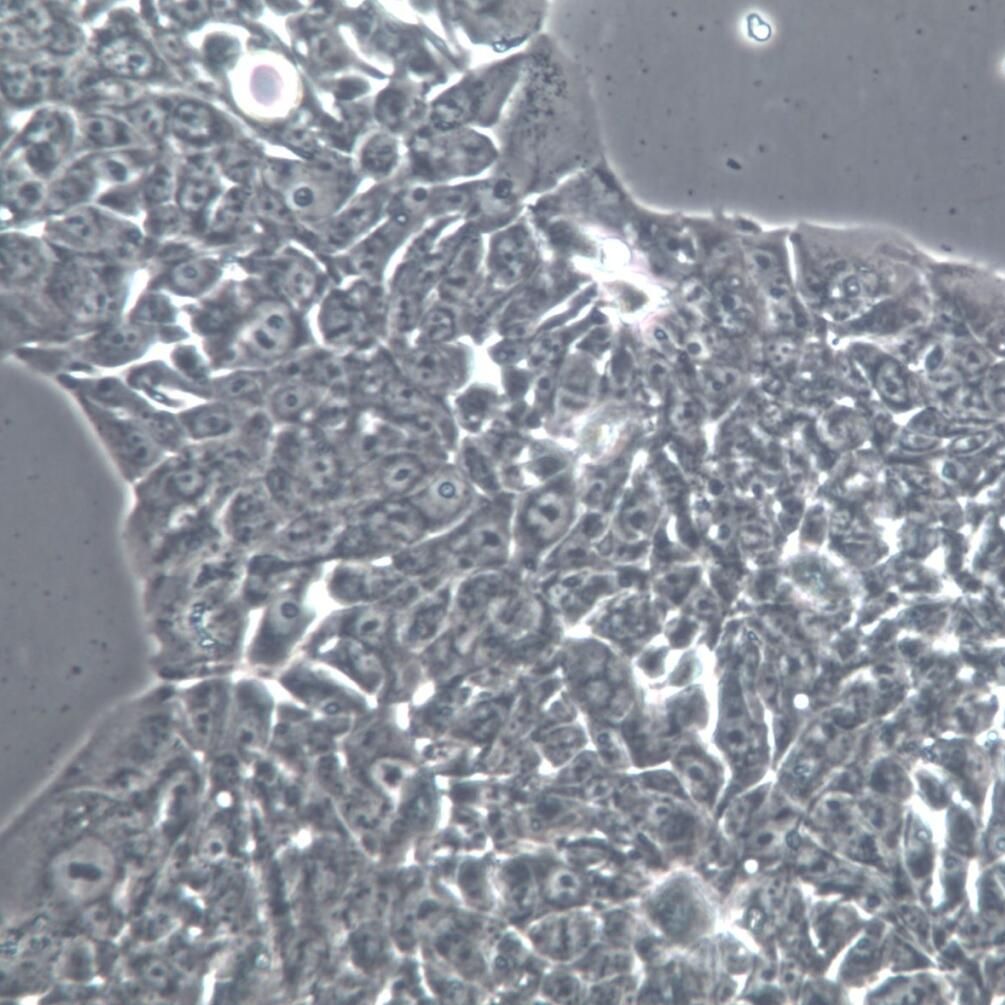 NCI-H358细胞株、NCI-H358细胞、NCI-H358非小细胞肺癌细胞