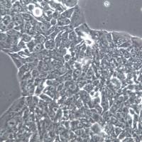 NCI-H358细胞株、NCI-H358细胞、NCI-H358非小细胞肺癌细胞