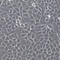 SACC-LM细胞株、SACC-LM细胞、SACC-LM涎腺腺样囊性癌细胞