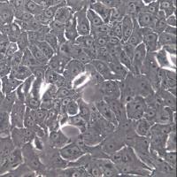 RT4；人膀胱移行细胞乳头瘤细胞、RT4、RT4细胞