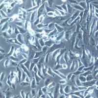 NCI-H1703细胞系、NCI-H1703细胞、NCI-H1703肺鳞癌细胞