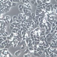 T47D细胞系、T47D细胞、T-47D细胞株