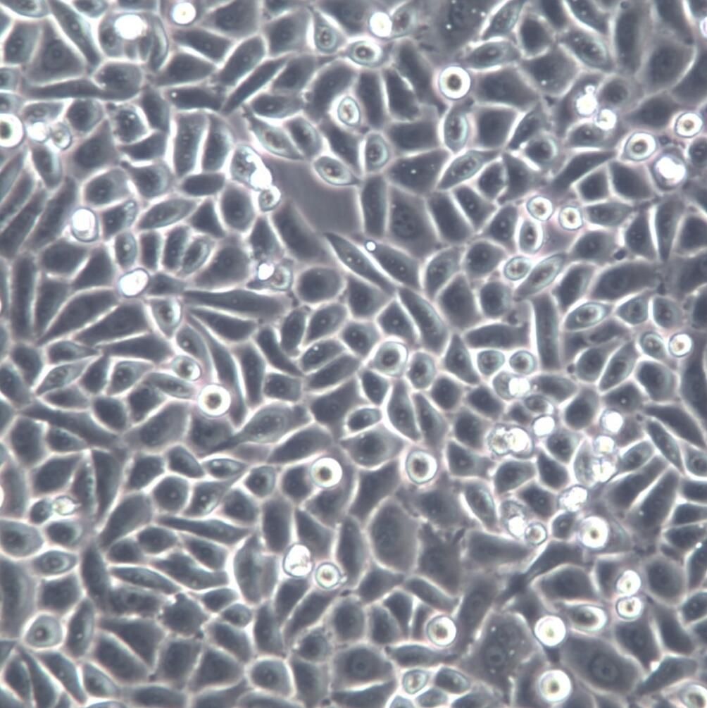 PC-9、PC9细胞系、PC-9、PC9细胞、PC-9、PC9腺癌细胞