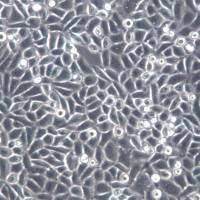 PC-9、PC9细胞系、PC-9、PC9细胞、PC-9、PC9腺癌细胞