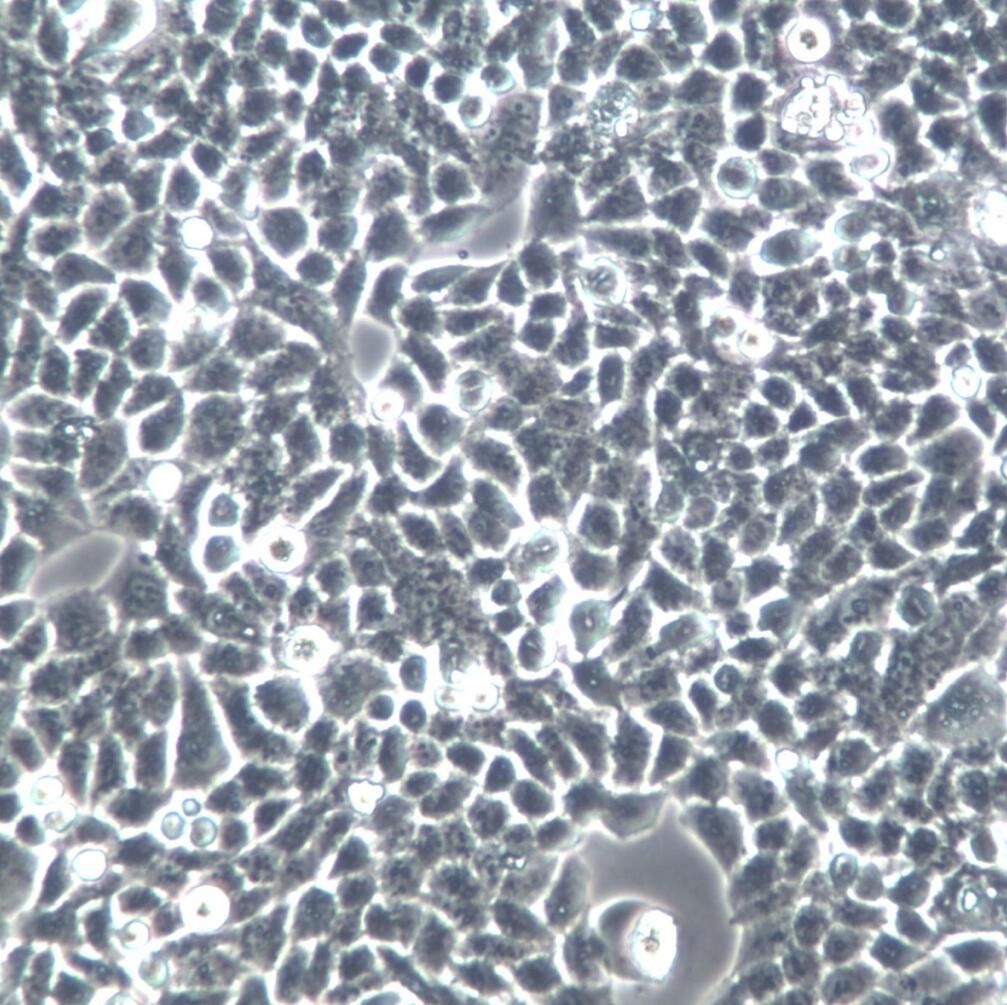 Tca-8113；人舌鳞癌细胞、Tca-8113细胞、Tca-8113细胞
