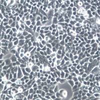 Tca-8113;人舌鳞癌细胞、Tca-8113细胞、Tca-8113细胞