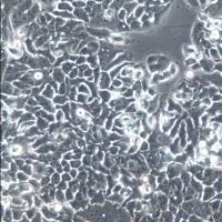 NCI-H1437细胞系、NCI-H1437细胞、NCI-H1437肺癌细胞