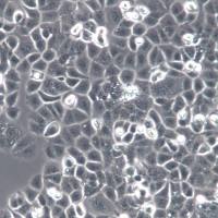 HEC-1-A细胞系、HEC-1-A细胞、HEC-1-A子宫内膜腺癌细胞