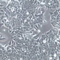 HCT-8[HRT-18]细胞系、HCT-8[HRT-18]细胞、HCT-8[HRT-18]回盲肠癌细胞，