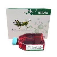 MHCC-97H-LUC-EGFP/人高转移性肝癌细胞-荧光素酶标记-绿色荧光蛋白(STR鉴定正确)