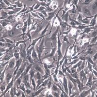 SNB-19 细胞系、SNB-19 细胞、SNB-19 胶质瘤细胞