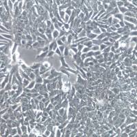 HCT-15细胞系、HCT-15细胞、HCT-15结肠癌细胞