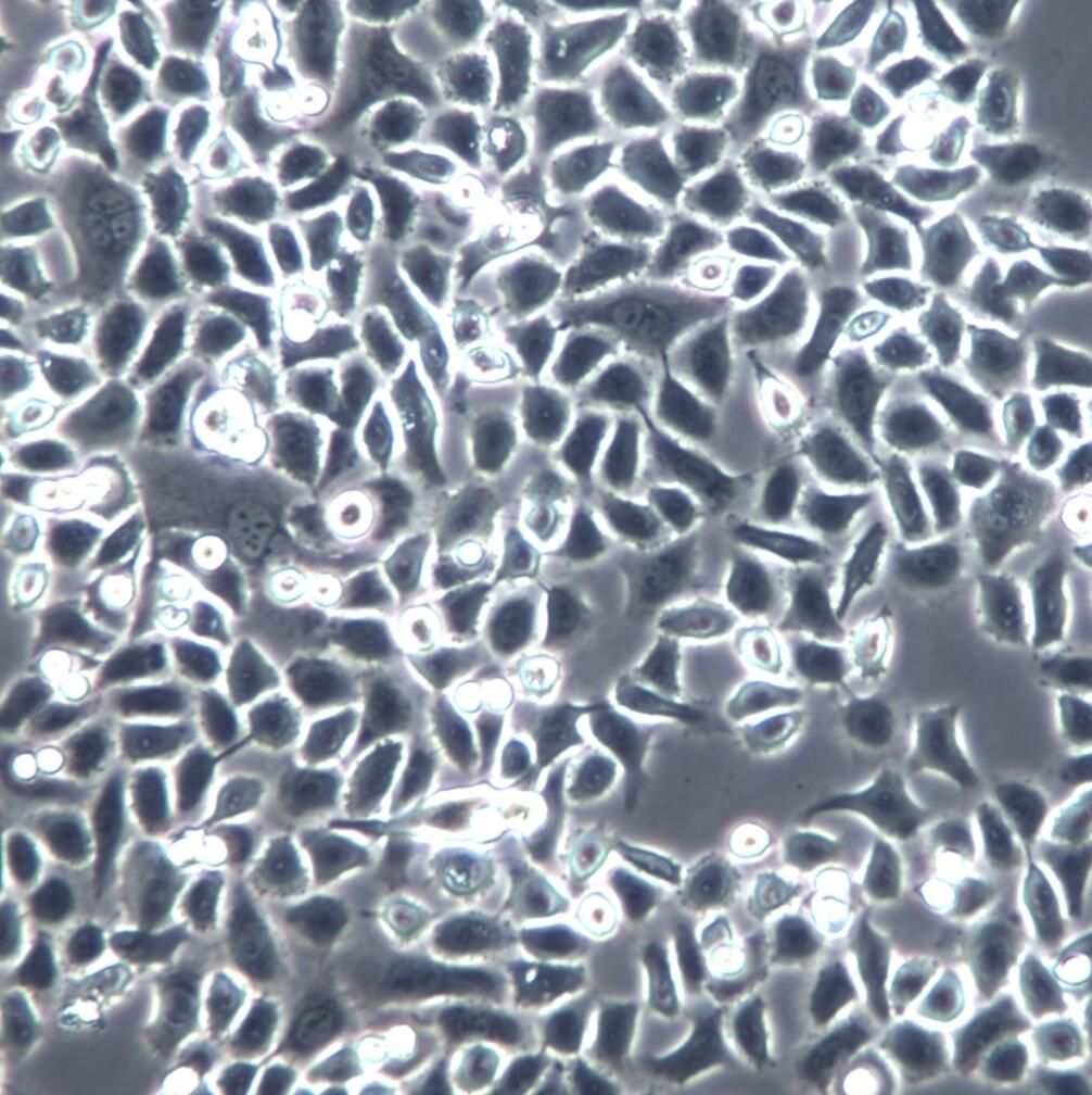 ME-180细胞系、ME-180细胞、ME-180子宫颈表皮癌细胞