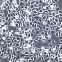 ME-180细胞系、ME-180细胞、ME-180子宫颈表皮癌细胞