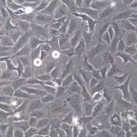 HOS细胞系、HOS细胞、HOS骨肉瘤细胞