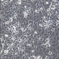 IOMM-Lee 细胞系、IOMM-Lee 细胞、IOMM-Lee 脑膜瘤细胞