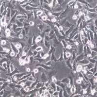 PATU8988T细胞系、PATU8988T细胞、PATU8988T胰腺癌细胞