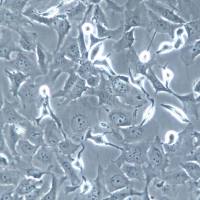 HCC38细胞系、HCC38细胞、HCC38乳腺导管癌细胞