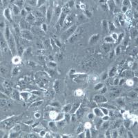 HUCCT1细胞株、HUCCT1细胞、HUCCT1胆管癌细胞 