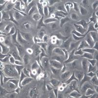 HCC1806细胞系、HCC1806细胞、HCC1806乳腺癌细胞