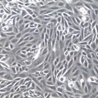 SNU-449细胞系、SNU-449细胞、SNU-449肝癌细胞