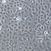 OVCAR-3细胞系、OVCAR-3细胞、OVCAR-3卵巢腺癌细胞