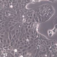 PL45 细胞系、PL45 细胞、PL45 胰腺导管腺癌细胞