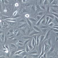 GBC-SD细胞系、GBC-SD细胞、GBC-SD胆囊癌细胞