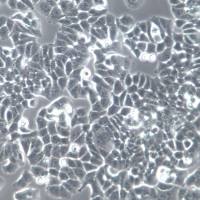 T47D细胞系、T47D细胞、T47D乳腺导管癌细胞