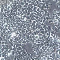 NCCIT 细胞系、NCCIT 细胞、NCCIT 畸胎癌细胞  