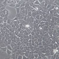 KYSE-510细胞系、KYSE-510细胞、KYSE-510食管癌细胞