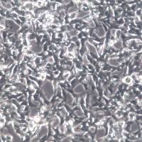 SK-N-BE(2) 细胞、SK-N-BE(2) 细胞系、SK-N-BE(2) 神经母细胞瘤细胞