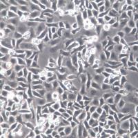 TOV-21G细胞系、TOV-21G细胞、TOV-21G卵巢癌细胞