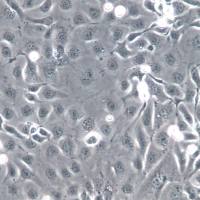 NCI-H2347细胞系、NCI-H2347细胞、NCI-H2347非小细胞肺癌细胞