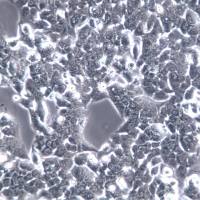 NCI-H1944细胞、NCI-H1944细胞系、NCI-H1944肺癌细胞