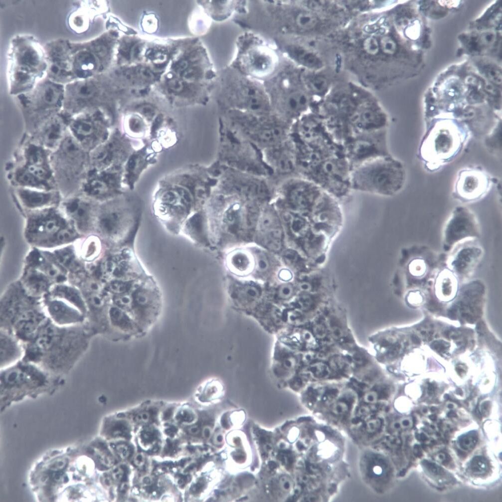 PLC/PRF/5;人肝癌亚力山大细胞、PLC/PRF/5细胞、PLCPRF5