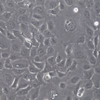 KYSE-410细胞系、KYSE410细胞、KYSE-410食管鳞癌细胞