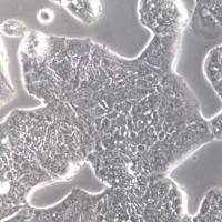 SW1116、SW-1116；SW1116细胞