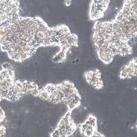 ZR-75-1细胞、ZR-75-1细胞系、ZR-75-1乳腺癌细胞