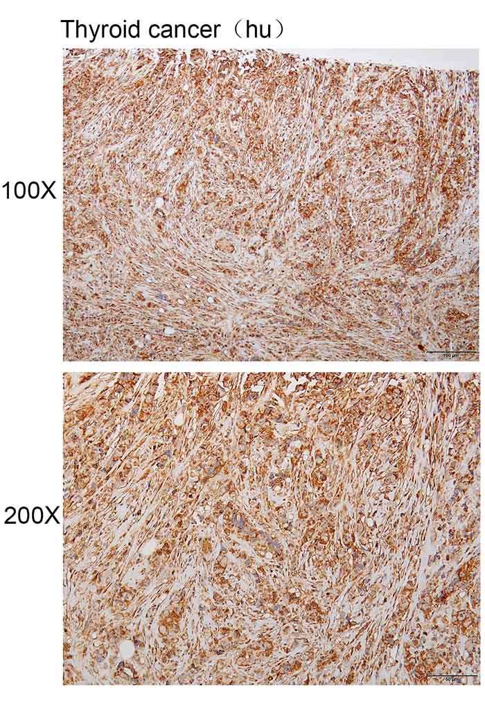 K114147P Anti-MAP3K8 Polyclona