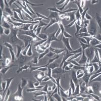 SMMC-7721细胞、SMMC-7721细胞系、SMMC-7721肝癌细胞                             