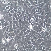 HCC1954细胞系、HCC1954细胞、HCC1954乳腺癌细胞