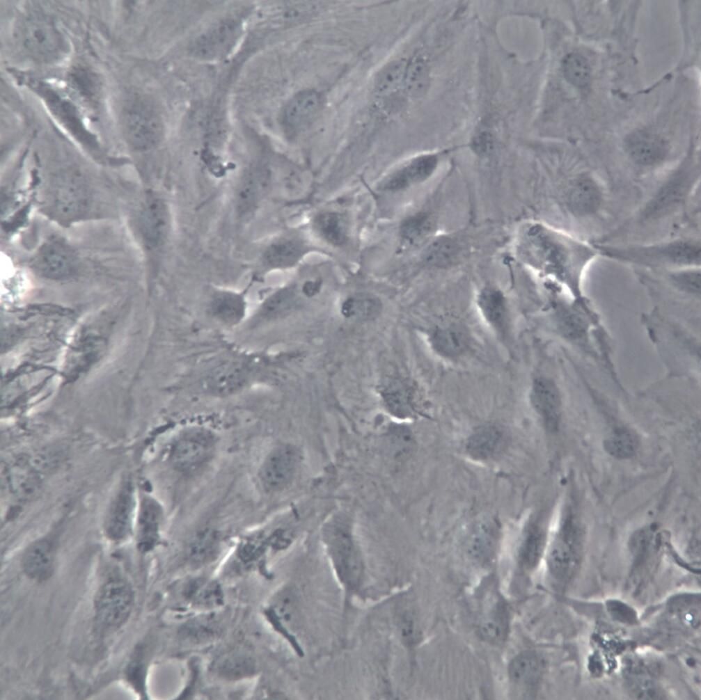 SNU-387细胞系、SNU-387细胞、SNU-387肝癌细胞