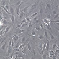 SNU-387细胞系、SNU-387细胞、SNU-387肝癌细胞