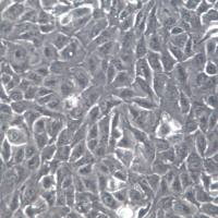 RBE细胞、RBE细胞系、RBE肝胆管癌细胞