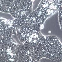 NCI-N87细胞株、NCI-N87细胞、NCI-N87胃癌细胞