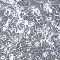 MKN-28细胞系、MKN28细胞、MKN-28胃癌高转移细胞