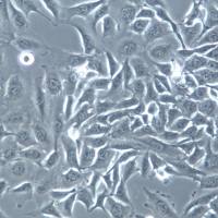 NCI-H1975细胞、NCI-H1975细胞、NCI-H1975细胞