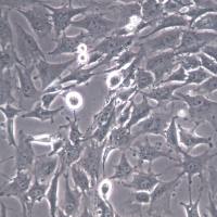 Hs 578T细胞系、Hs 578T细胞、Hs 578T乳腺癌细胞